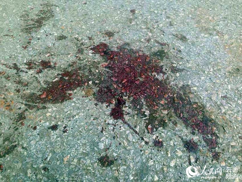 昆明警察抓小偷被捅伤 目前仍在医院抢救【组